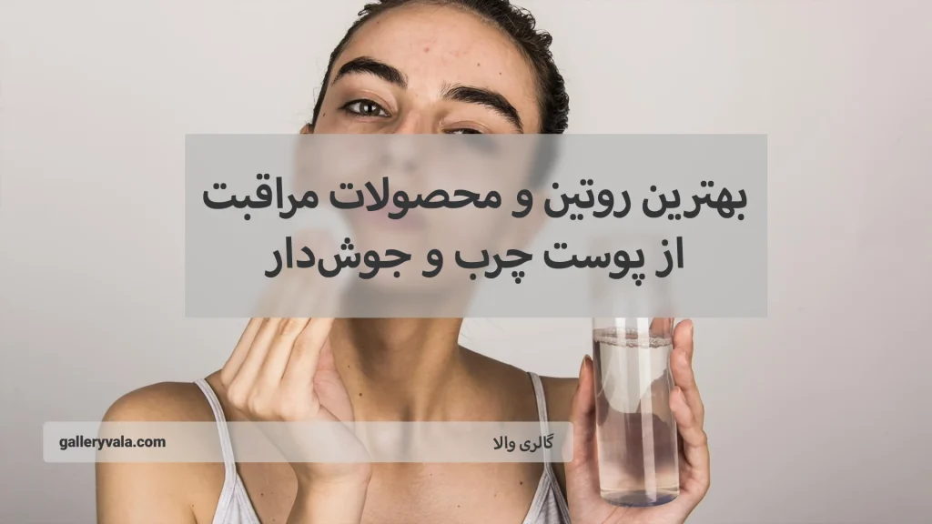 بهترین روتین و محصولات مراقبت از پوست چرب و جوش‌دار