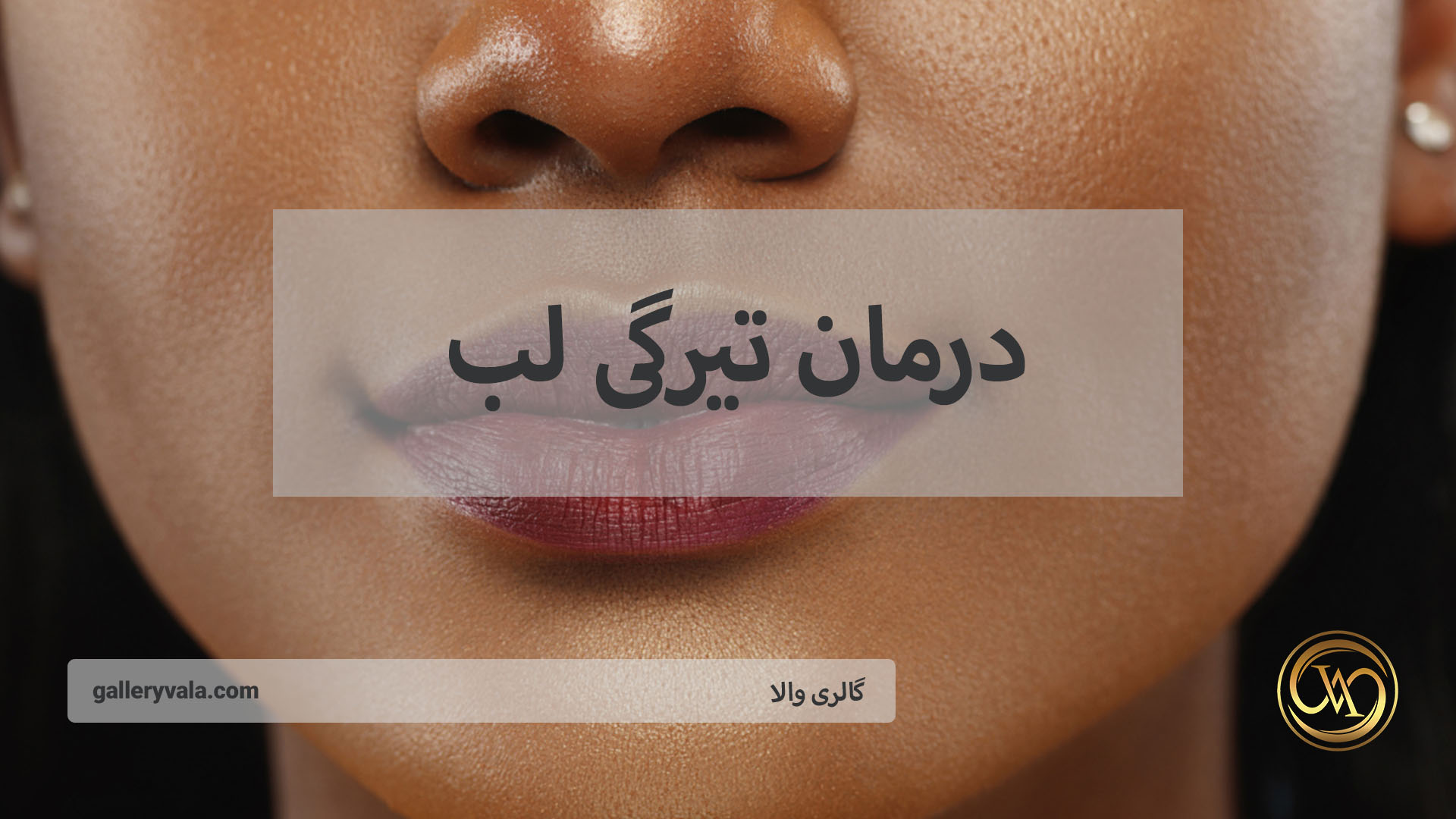 روش‌های جدید و موثر رفع سیاهی لب | گالری والا